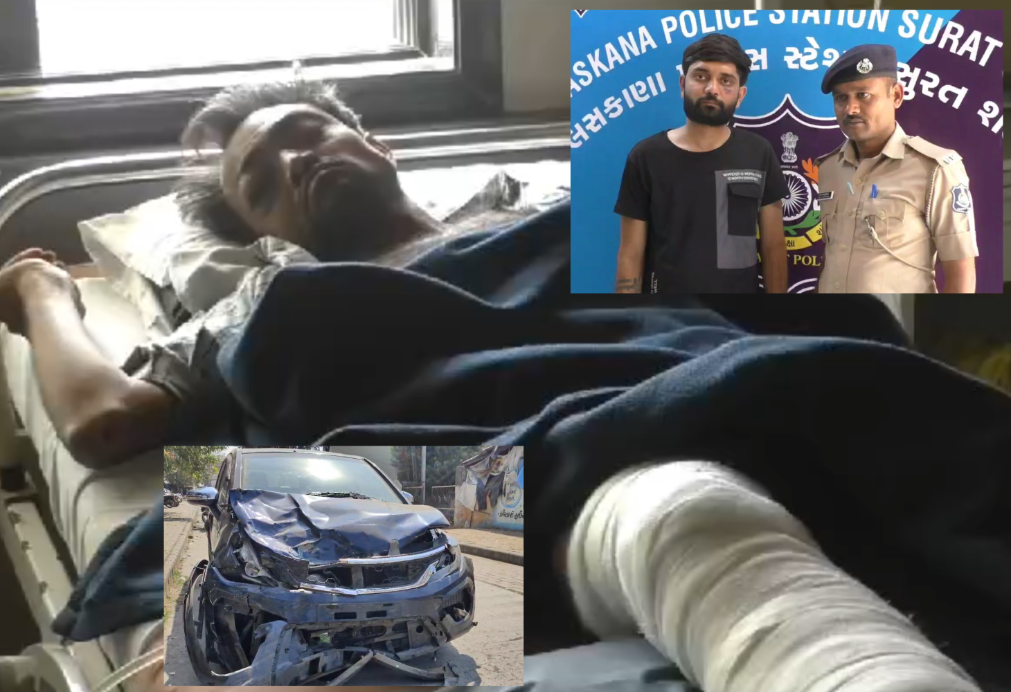 સુરતના વાલક બ્રિજ પર અકસ્માત મામલે ઘટસ્ફોટઃ નબીરાઓના નશાના કારણે બે ભાઈના મોત