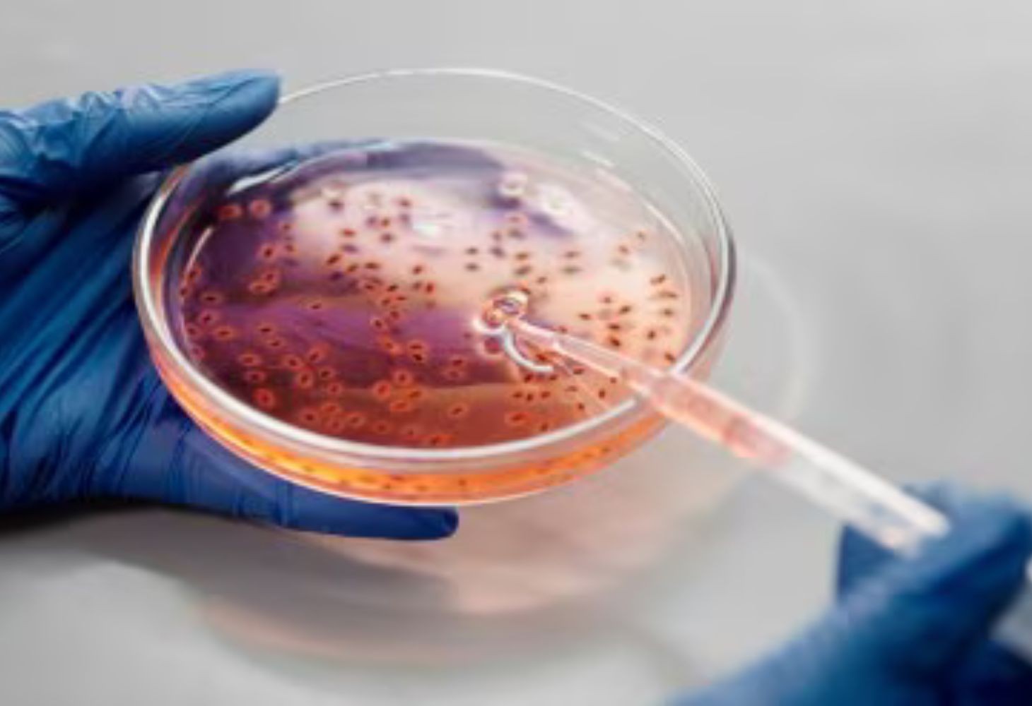 WHO says Nipah outbreak in India poses low risk