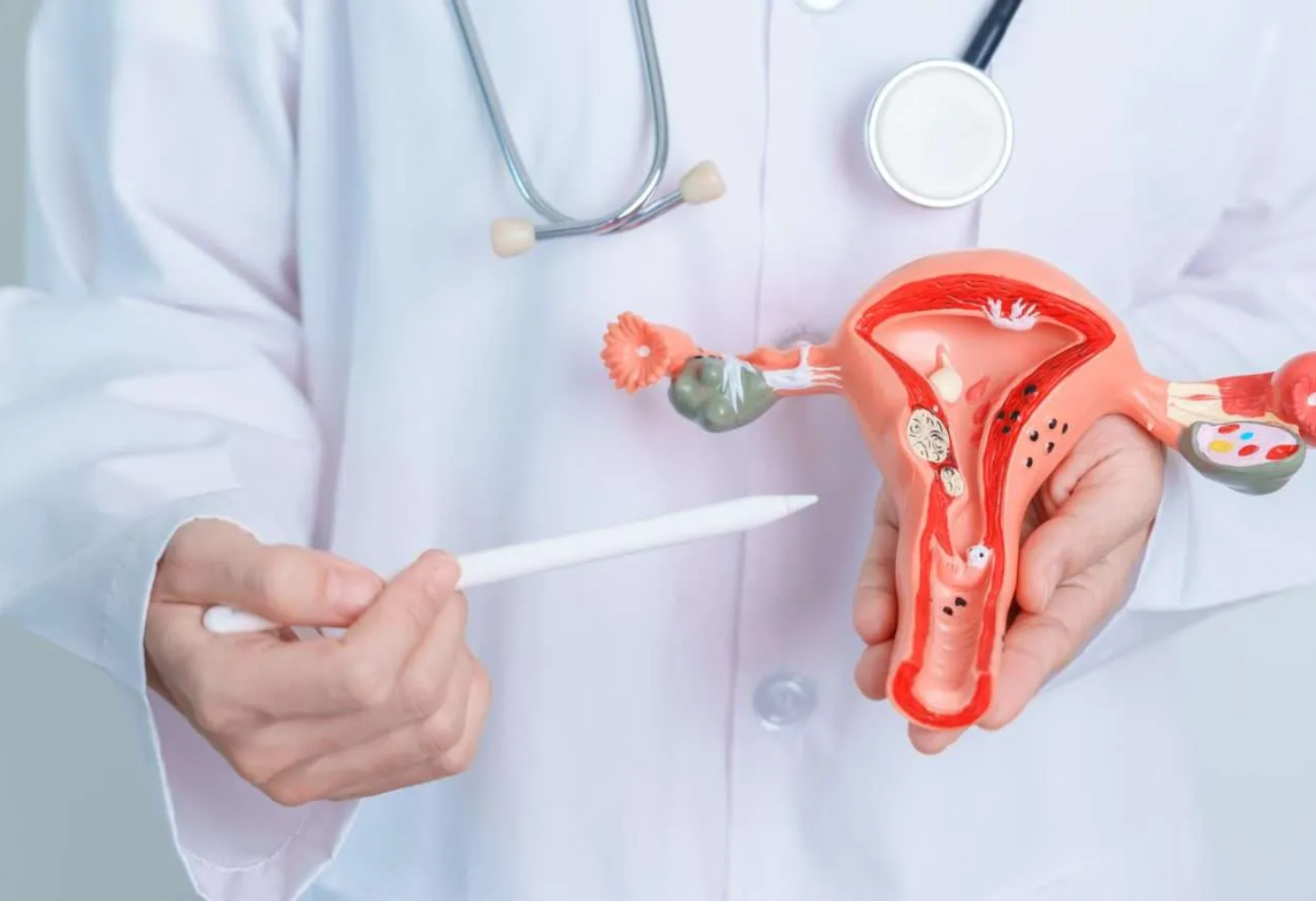 શું ૧૫ વર્ષની છોકરીઓને પણ થાય છે PCOS?