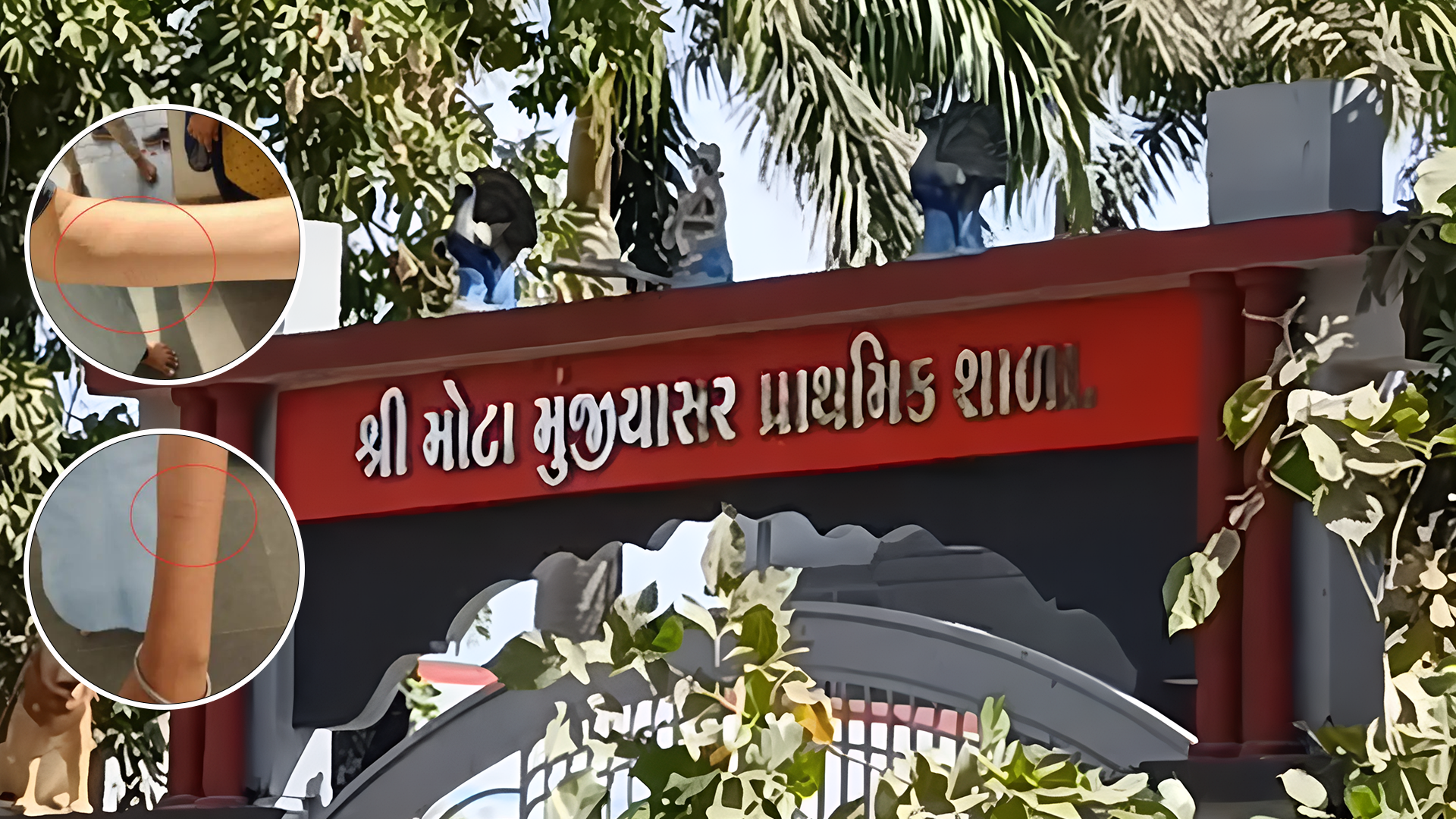 40 વિદ્યાર્થીઓએ કેમ પોતાની જાતે હાથ-પગ પર બ્લેડના કાપા માર્યા