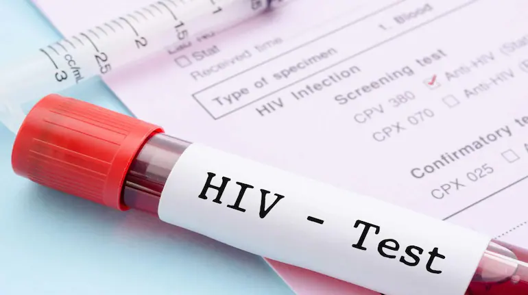 રાજ્યમાં HIV સંક્રમણ વધી રહ્યું હોવાથી ત્રિપુરા એલર્ટ પર, 47 વિદ્યાર્થીઓના મોત, 828 પોઝિટિવ મળ્યા