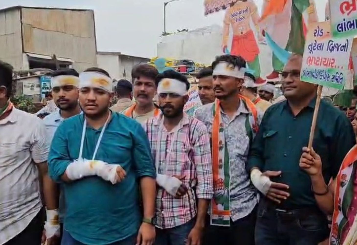 અમદાવાદના રોડ-ગટર પ્રશ્ને કોંગ્રેસનો હલ્લાબોલ, પાટા-પિંડી બાંધી અનોખો વિરોધ